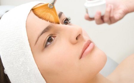 Пилинги и их виды