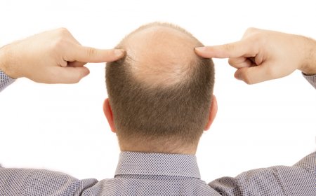 Эффективный массаж для профилактики и лечения облысения