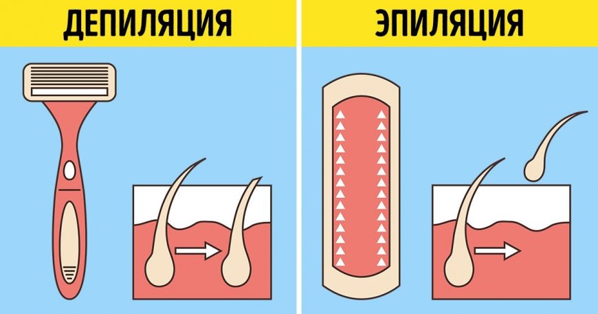 В чем отличия между эпиляцией и депиляцией?