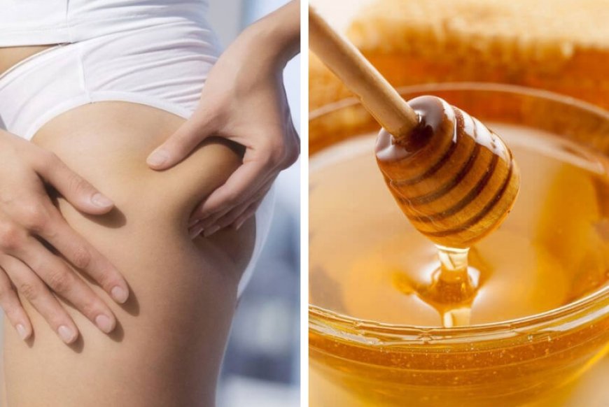 Польза антицеллюлитного массажа с медом