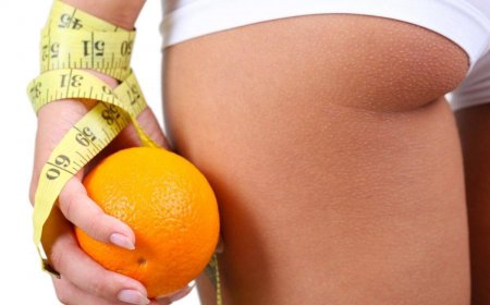 Эти продукты любит… целлюлит!