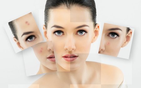 Уход за проблемной кожей лица