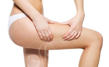 Как избавиться от целлюлита на бедрах и ягодицах