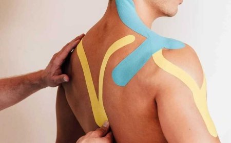 Кинезиотейпирование: перспективное направление современной медицины