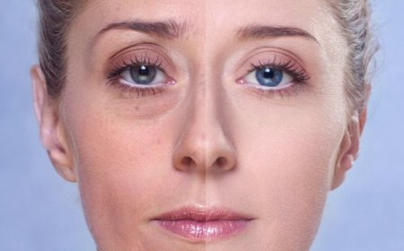 Как убрать отёчность лица. Полезные рекомендации