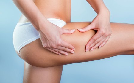 Целлюлит варианты решения проблемы