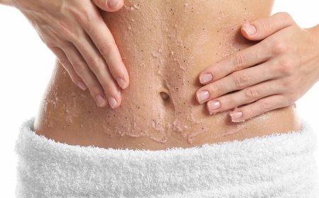 Можно ли избавиться от растяжек?