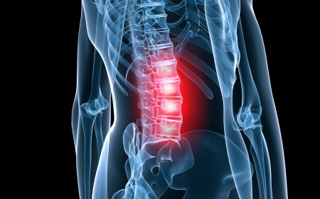 Заболевание остеохондроз