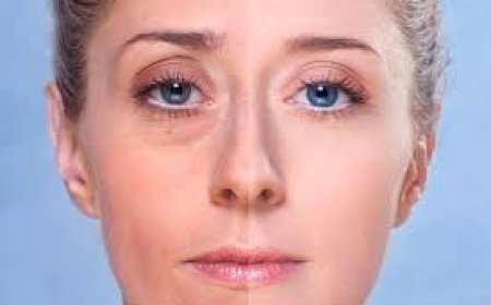 Как избавиться от отеков