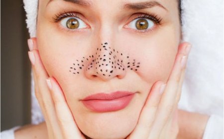 Как избавиться от черных точек на лице: лучшие натуральные средства