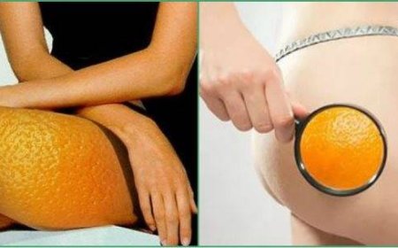 Как быстро справиться с целлюлитом