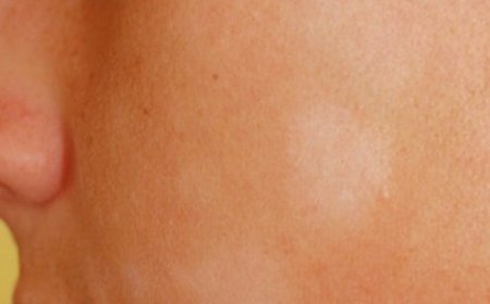 Почему загар после солярия пятнами