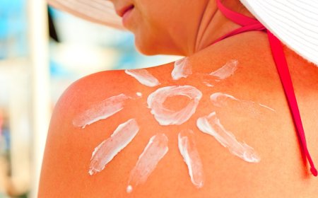 Домашние средства от солнечных ожогов