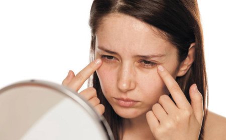 На лице появились отёки. В чём дело и что можно с этим сделать