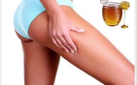 Как избавиться от целлюлита