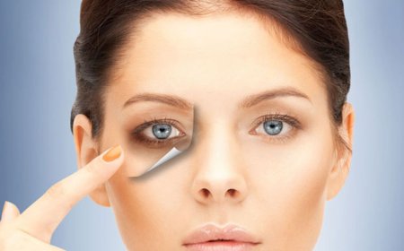 Как бороться с отеками и темными кругами под глазами