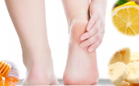 Как избавиться от трещин на пятках