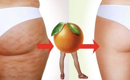 Как эффективно бороться с целлюлитом