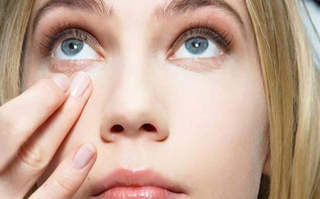 Как бороться с отечностью глаз