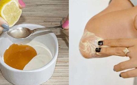 Смягчаем локти