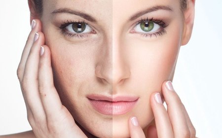 Как улучшить состояние тусклой кожи