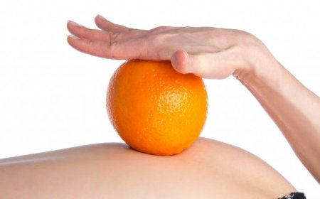 Как бороться с «апельсиновой коркой»