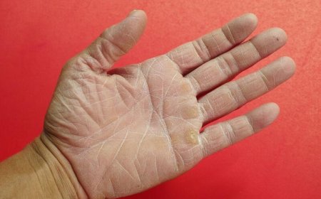 Трещины на коже