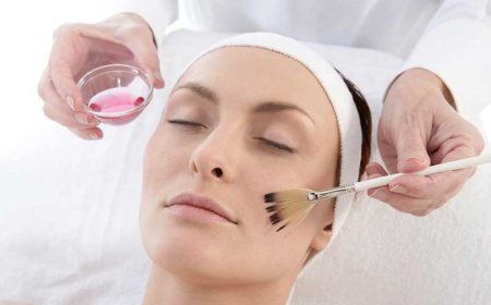 Химический пилинг - хемабразия