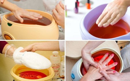 Парафинотерапия