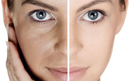 Как уменьшить расширенные поры?