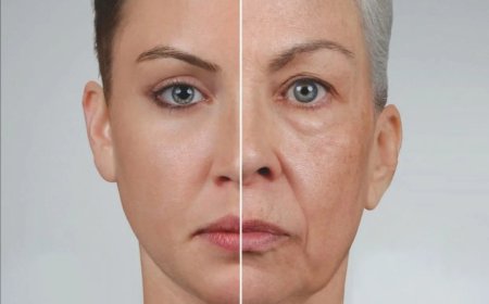 Отвислые щеки: правильно боремся с этой проблемой