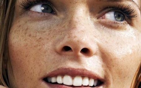 Выводим пигментные пятна в домашних условиях