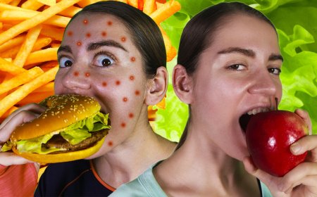 Есть ли какая-либо связь питания и угревой сыпи