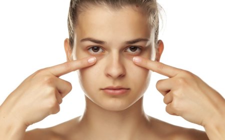 Круги под глазами не только от недосыпа. Каковы возможные причины и можно ли их эффективно устранить?