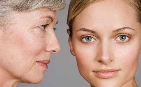 Увядающая кожа