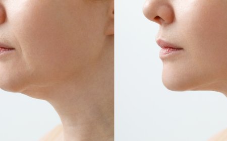 Как избавиться от двойного подбородка