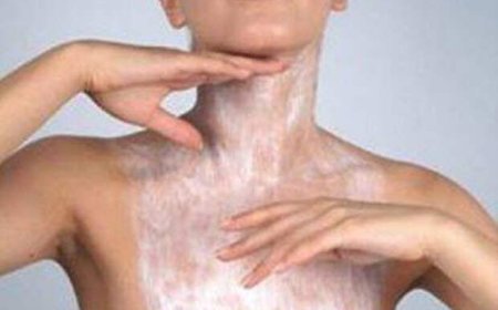 Маски молодости: уход за кожей шеи и декольте