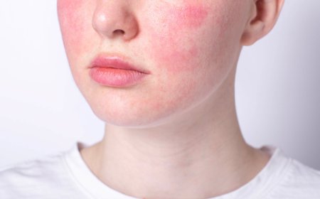 Обветренная кожа на лице и руках: как восстановить ее и защитить от нового обветривания?