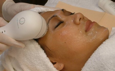 Механический пилинг