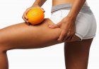 Целлюлит: как помочь коже стать упругой и здоровой