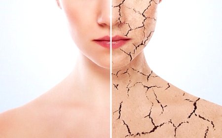 Болезненная кожа? Есть способы решить проблему