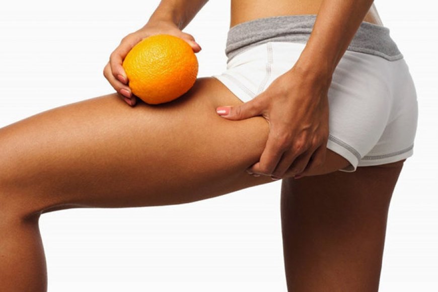 Целлюлит: как помочь коже стать упругой и здоровой