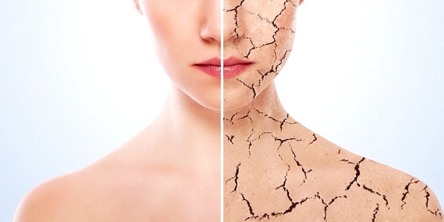 Болезненная кожа? Есть способы решить проблему